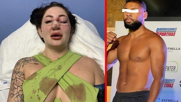 Peter Nowaczek con mujer agredida con ojos tapados